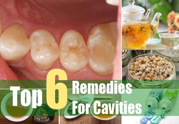 6-herbal-remedies-for-cavities-livinggreenandfrugally