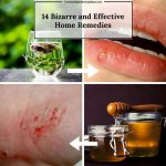 14 Bizarre & Unlikely Home Remedies