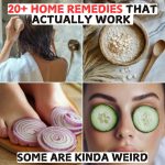 20+ Home Remedies that Actually Work