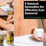 9-Natural-Remedies-for-Effective-Scar-Removal