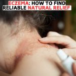 Eczema: How to Find Reliable Natural Relief 