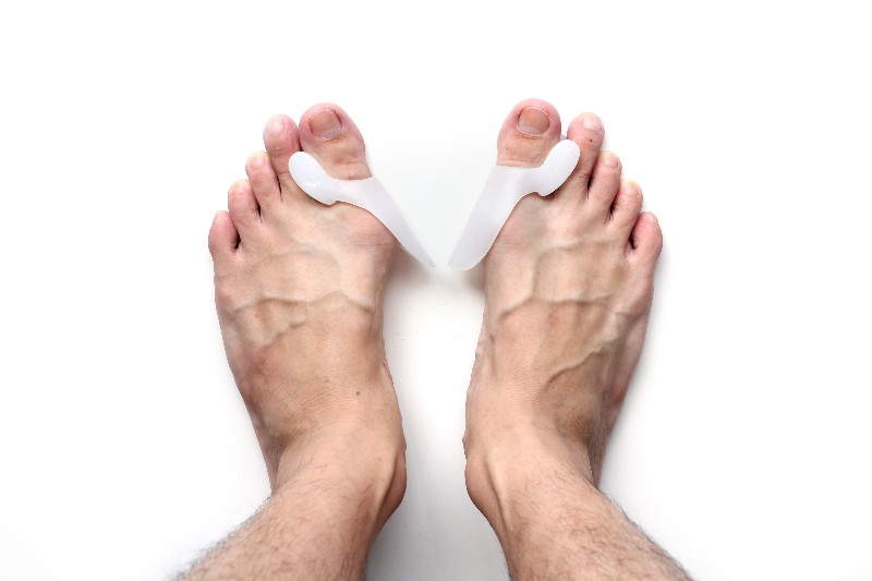 Gel Pads and Bunion Splints