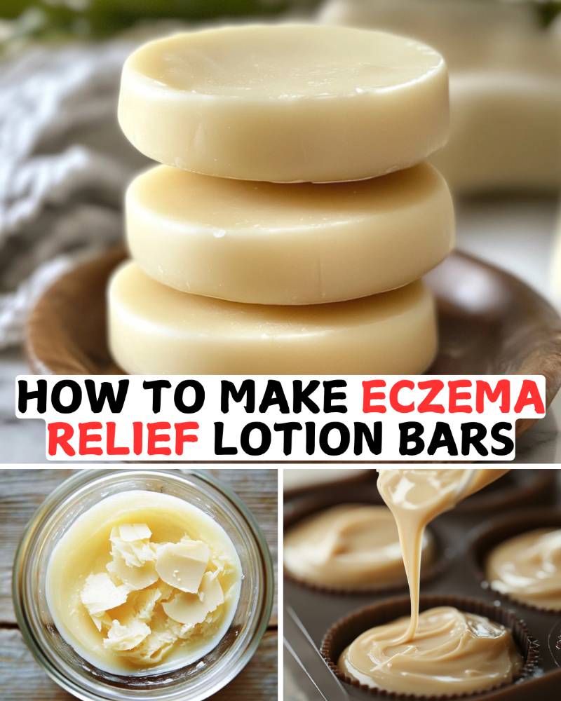 How To Make Eczema Relief Lotion Bars